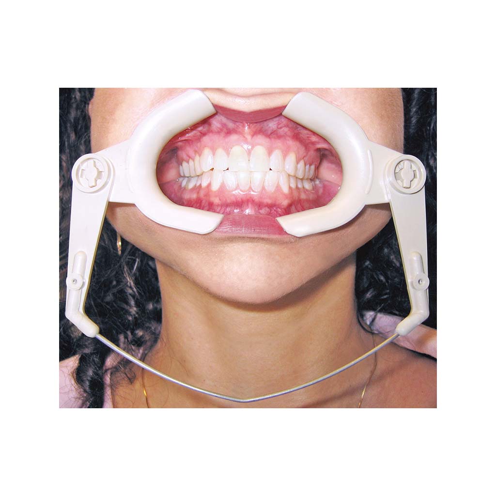 Ortho Technology High Heat Cheek Retractor Each